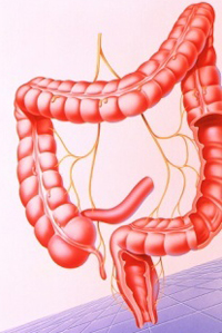 Неопухолевые заболевания толстой кишки